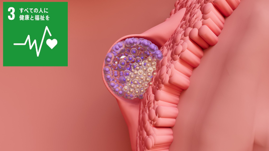 ヒト胚着床現象を高度に模倣することに世界で初めて成功着床機序の解明や不妊治療法の開発に期待