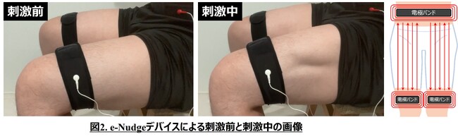 運動代替セルフケアソリューション 「e-Nudge（イーナッジ）(R)」 プロジェクト始動