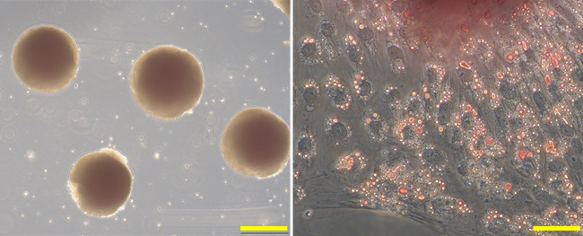 【研究報告】ヒトiPS細胞を用いた抗肥満効果をもつ活性化因子スクリーニング系を開発 肥満タイプ別iPS細胞から褐色脂肪細胞の分化に成功