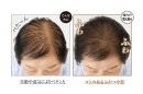 梳かすだけでふわっとボリュームアップ 梳かすだけでふわっとボリュームアップ