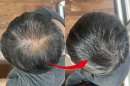 使用例 男性 使用例 男性