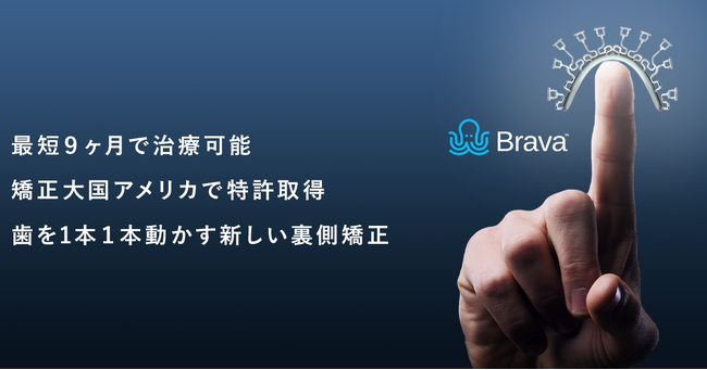 最短9ヶ月！治療期間が短い裏側矯正Brava（ブラーバ）：より装着しやすく、痛みや違和感をさらに抑える形状へアップデート