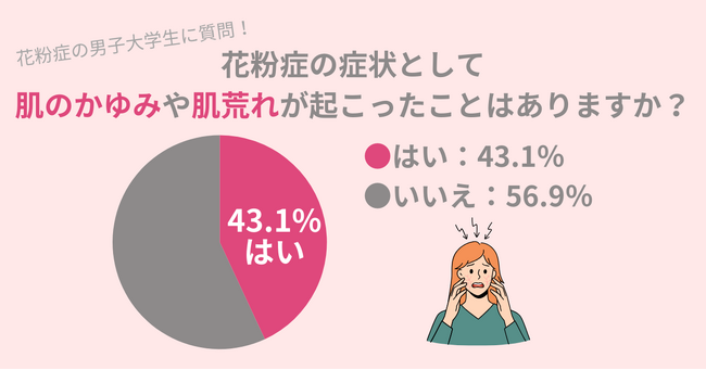 男子学生に調査！花粉症の方のうち、43.1％が花粉で肌に症状アリ