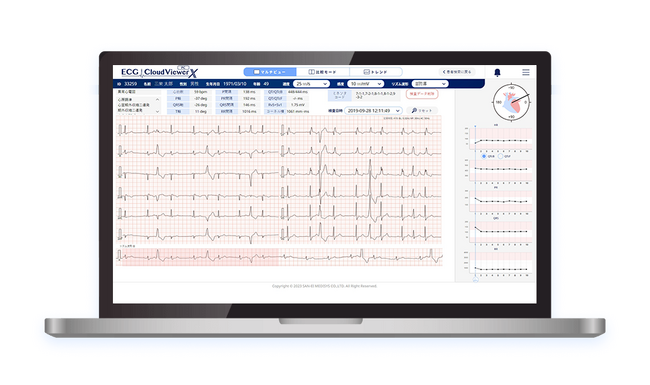 パソコン心電計「PC-ECG」対応の心電図クラウドビューアサービスを2024年4月1日より開始