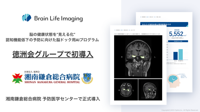 【徳洲会グループで初導入】ブレインヘルスケアのSplink、脳ドック用AIプログラム「Brain Life Imaging(R)」を湘南鎌倉総合病院で正式導入