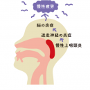 「慢性疲労」は、脳の炎症、迷走神経の炎症がもたらす病気です 「慢性疲労」は、脳の炎症、迷走神経の炎症がもたらす病気です