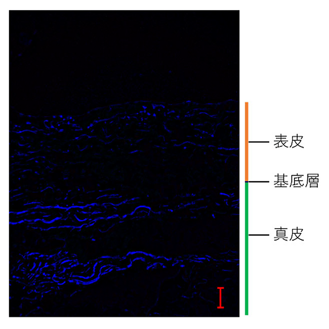 【快挙】NMNエクソソーム配合の新型37％ビタミンC美容液の国立大学臨床試験結果が日本抗加齢（アンチエイジング）医学会総会で6/1発表