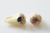 大正健康ナビ、5/29に新着情報「虫歯」を公開!