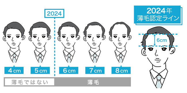 全国4,700名が本気で回答！「2024年版　薄毛の境界線」を発表眉毛上から生え際6cmで薄毛認定、20代は5cm台と見た目に厳しく薄毛に最も厳しい都道府県は“愛知県”、最も寛容なのは“長野県”