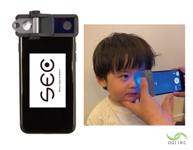 OUI Inc. が山梨県立盲学校の学校検診でSmart Eye Cameraを活用した実証に着手