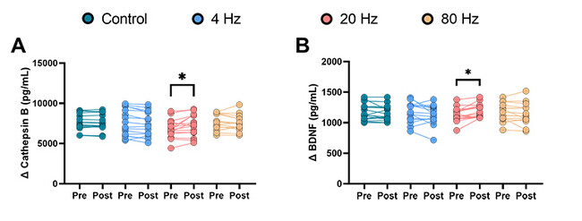 マイオカインの発現に効果的な周波数帯を解明。研究成果が『Journal of Comparative Physiology B』に掲載