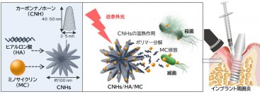 【名城大学・北海道大学】インプラント周囲炎に対する光応答性ナノ複合体を開発～インプラント周囲炎の新しい治療法への応用に期待～