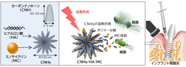 【名城大学・北海道大学】インプラント周囲炎に対する光応答性ナノ複合体を開発