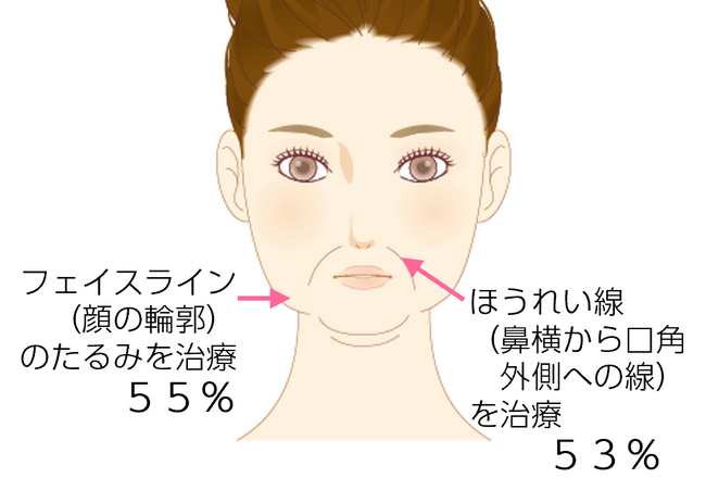 たるみ治療、何をした？効果はあった？意外!? 満足度1位は “ボトックス” 。７４％が「受けてよかった」