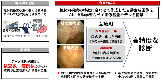 画像基盤モデルにより専門医に匹敵する膀胱内視鏡診断支援AIを開発