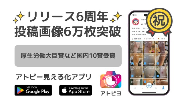 日本最大級のアトピー患者向けアプリ「アトピヨ」が6周年を迎え、投稿画像は6万枚突破！ ～リリース6年で、厚生労働大臣賞など国内10賞を受賞～