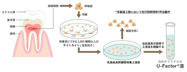 U-Factor(R)液による治療薬開発を目指す株式会社U-Factorが東京慈恵会医科大学と共同研究契約を締結