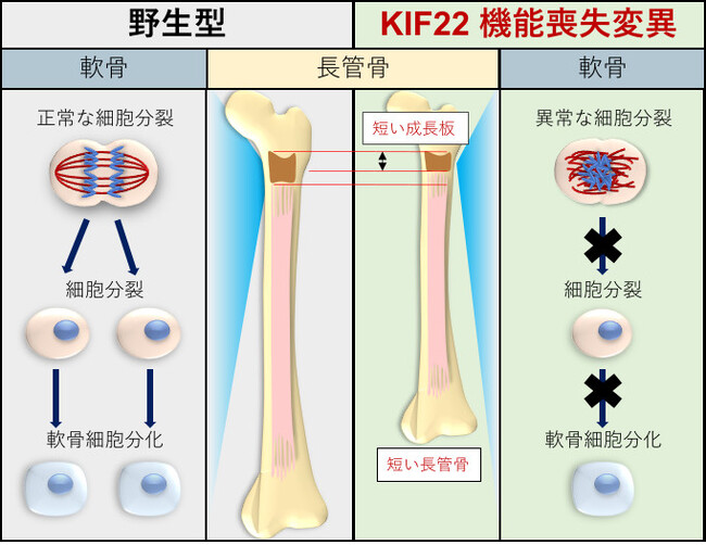 関節弛緩を伴う脊椎骨端骨幹端異形成症2型の責任遺伝子KIF22の機能を解明　～難病の病因解明に一歩前進～