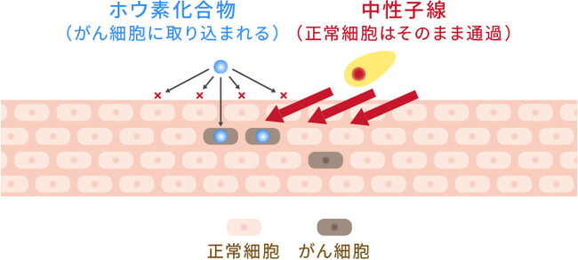 株式会社CICS（リゾートトラスト株式会社の連結子会社）、国立研究開発法人 国立がん研究センター、住友重機械工業株式会社、ならびにステラファーマ株式会社とBNCTの治験に係る契約を締結