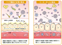 短鎖脂肪酸で腸内環境を整える ~免疫力向上のススメ~