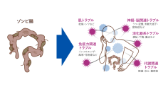 日本初の便秘外来を開設した小林弘幸教授が提唱する新キーワード「ゾンビ腸」 現代日本人の約6割が「ゾンビ腸」化 そのカラダの不調は、すべて“不腸”のせいだった!?「ゾンビ腸」書籍化を記念し、対策メニューも登場