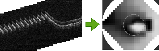 自治医科大学発ベンチャー・DeepEyeVision、AIを活用した緑内障診療の精度向上に向けた研究開発に着手