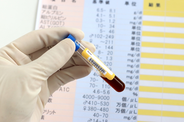 CTC検査「CTC Scancer」ヒロクリニックで10月1日開始！がんの超早期発見を可能に