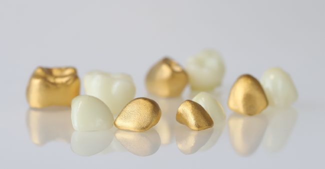 子どもの乳歯が純金製オブジェに！？乳歯を美しく残したいという想いから生まれた『金乳歯(R)』高島屋6店舗で販売開始
