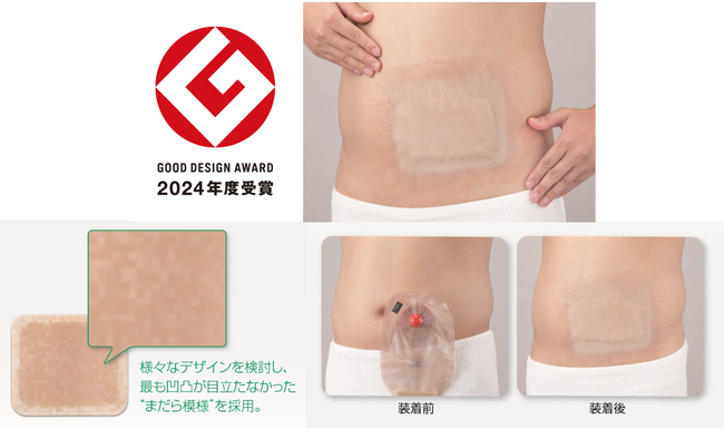 オストメイトの快適な入浴をサポートする入浴用シール〈バスラック(R)シール〉が「2024年度グッドデザイン賞」を受賞