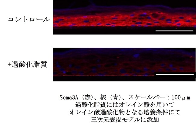 皮脂の酸化が頭皮のかゆみの一因となるメカニズムを確認