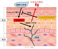 皮脂の酸化が頭皮のかゆみの一因となるメカニズムを確認