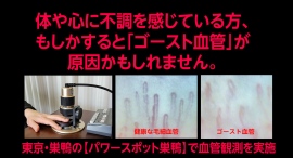 TV番組で話題!東京・巣鴨「パワースポット巣鴨」で毛細血管の血流観測サービスを毎週土曜日に実施 TV番組で話題!東京・巣鴨「パワースポット巣鴨」で毛細血管の血流観測サービスを毎週土曜日に実施