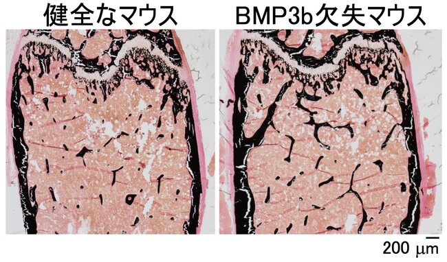 骨代謝における骨形成タンパク質BMP3bの機能を解明