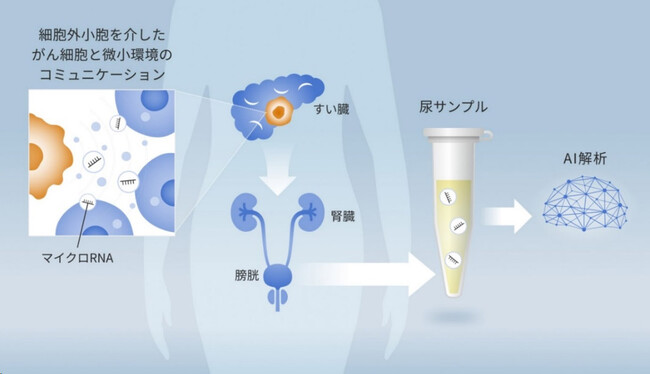 【慶應義塾】尿検査で膵臓がんを早期発見可能に！