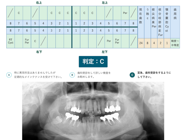 エックス線画像を用いた歯科健診サービスについて