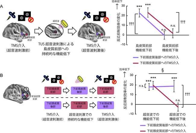 脳が「止める」を実現する経路の全容を解明