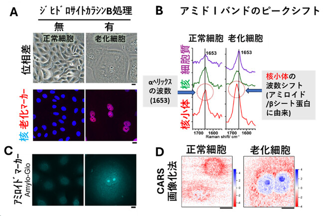 【慶應義塾】細胞の老化を高感度に可視化する画期的なラマン顕微画像化法を開発