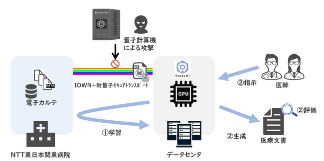 IOWN×tsuzumiを活用した医療文書作成支援AIモデルによる 医師の働き方改革に寄与する院内ＤＸ促進に向けた実証事業の開始