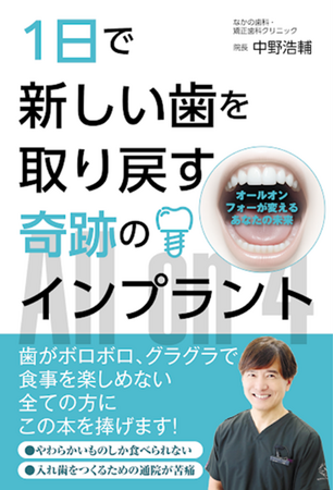 【書籍発売】地方トップクラスの施術数を誇る歯科医が、歯が無くてもできる最新インプラント治療を解説