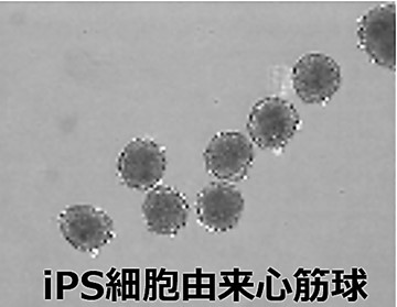 順天堂医院での治験1例目のiPS細胞由来心筋球治療を実施いたしました
