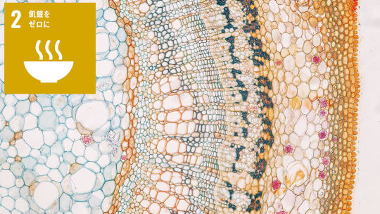 深層学習を用いた細胞骨格の高精度・高効率な密度解析法を確立