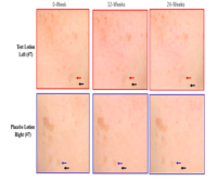 新規アスコルビン酸誘導体配合化粧品の老人性色素斑(シミ)に対する抗色素沈着効果がスイスMDPI社の学術雑誌「International Journal of Molecular Sciences」に掲載