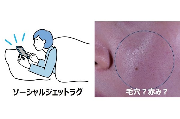 社会的時差ぼけ「ソーシャルジェットラグ」が毛穴の目立ちや顔の赤みを引き起こすことを確認