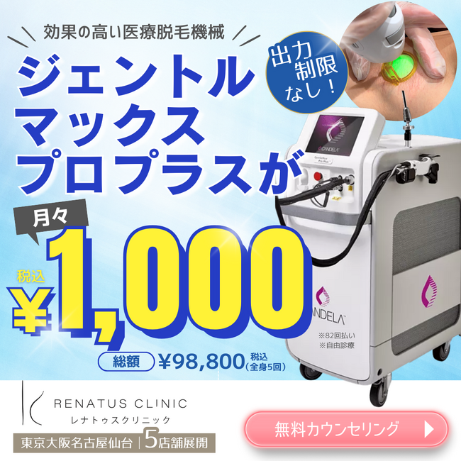 医療脱毛「Xプラン」レナトゥスクリニックが開始。熱破壊式ジェントルマックスプロプラス脱毛機で全身脱毛5回￥98,800で安い。全身顔VIOプラン、コース終了後の都度払いプランも発表。