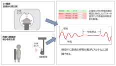 世界初！胸部X線撮影やCT検査時の呼吸状態を非接触で計測　ミリ波センサを用いた新たなモニタリングシステムを開発