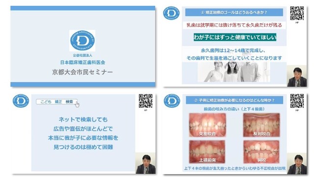 気になる“はえかわり時期の子どもの歯並び”「すきっ歯」「受け口になってる？」など子どもの歯の症状をチェック！一般市民の皆さまに向けて「日本臨床矯正歯科医会 公式Youtube」にてセミナー無料公開！