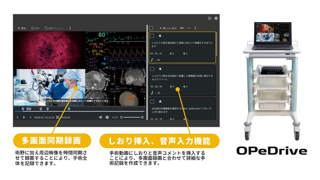 信州大学医学部附属病院 脳神経外科にてOPeDriveを導入