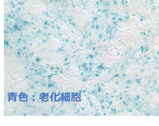世界初！キリンと東京大学が、ヒトiPS細胞由来小腸オルガノイドを用いた老化抑制素材の有効性確認に成功