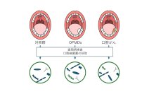 <横浜市立大学>口腔ケアが口腔がん予防に!
