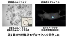 難治性卵巣癌に対する新たな治療戦略を発見